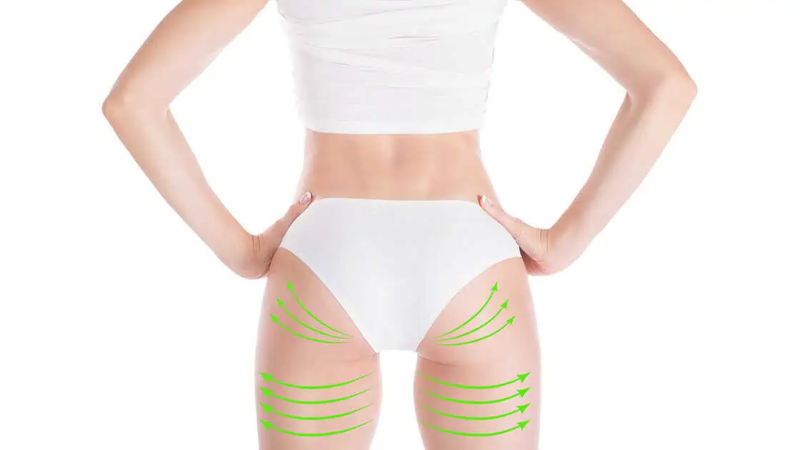 Butt Augmentation by MEADOW SURGICAL ARTS S Corp in Commerce, GA